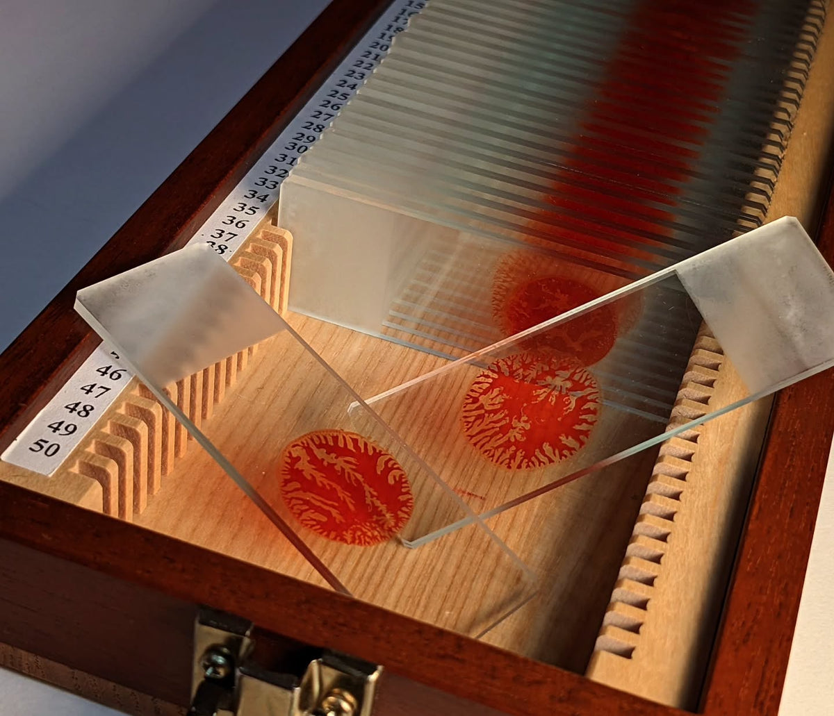 Handcrafted Trophy Case & 46 Blood Stained Slides V.2